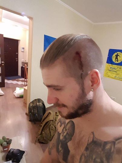 16 мая в Киеве напали на известного украинского десантника-блогера Валерия Ананьева.