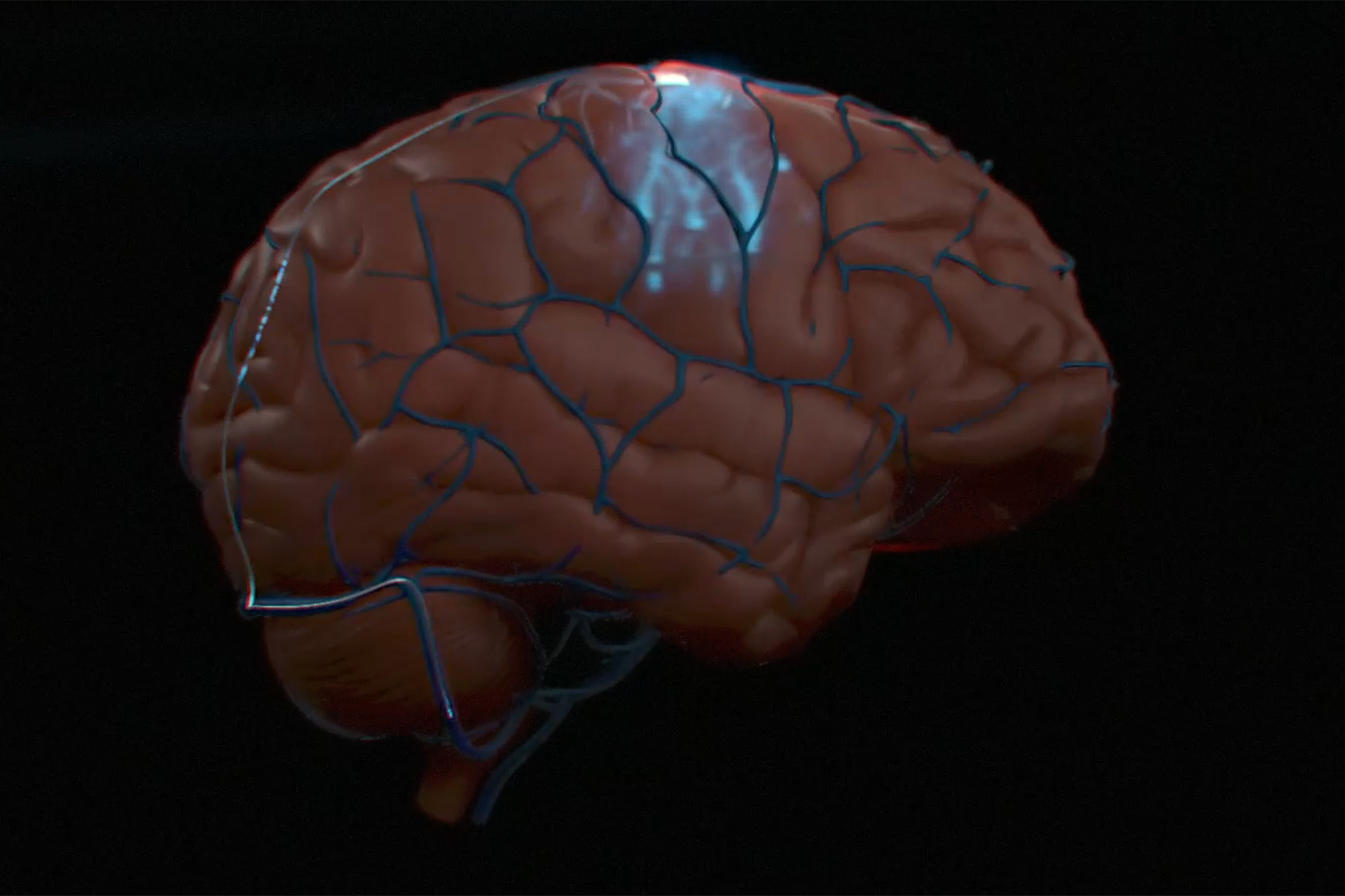 Brain 89. Мозг компьютера. Чип в мозг.
