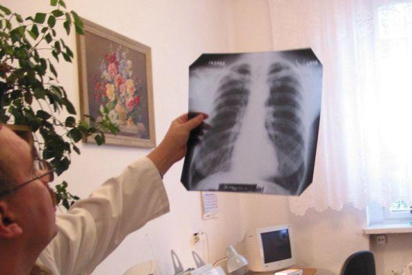 Поляки опасаются, что украинцы завезут в страну туберкулёз