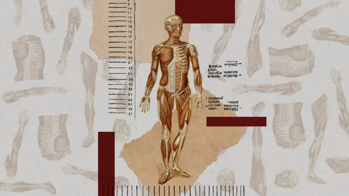 Зомби или прирождённые инвалиды «на органы»?